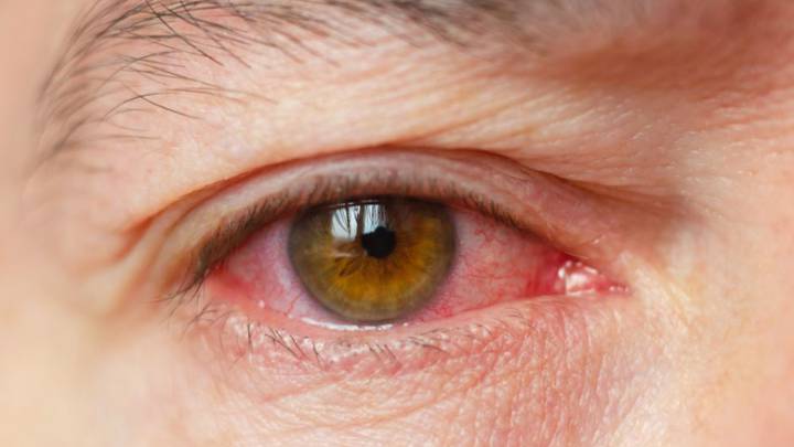 coronavirus covid-19 ojos contagio